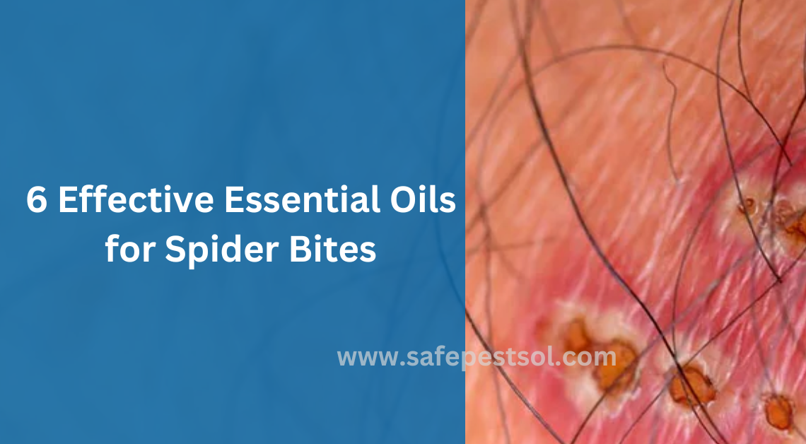 6 Effective Essential Oils for Spider Bites