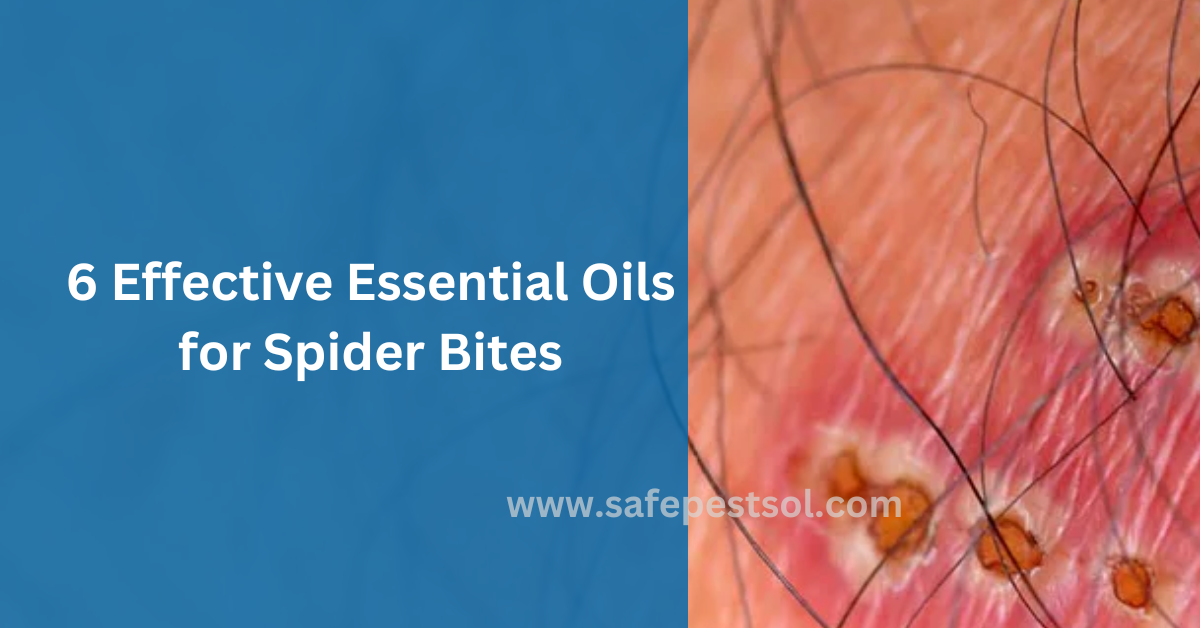 6 Effective Essential Oils for Spider Bites