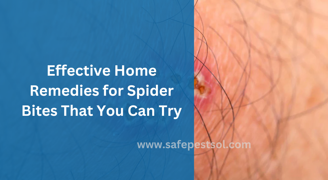 Home Remedies for Spider Bites