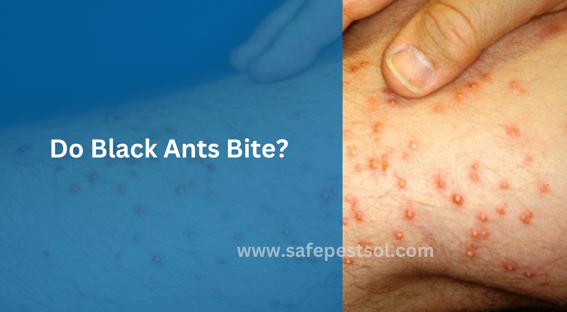 Do Black Ants Bite