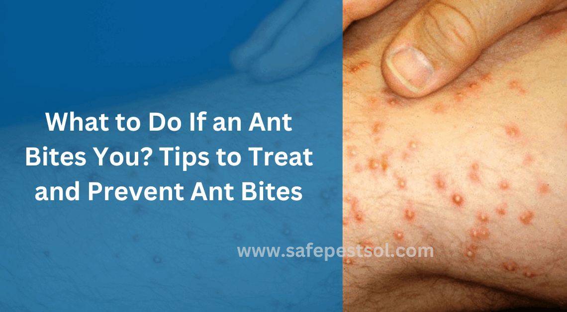 What to Do If an Ant Bites You Tips to Treat and Prevent Ant Bites