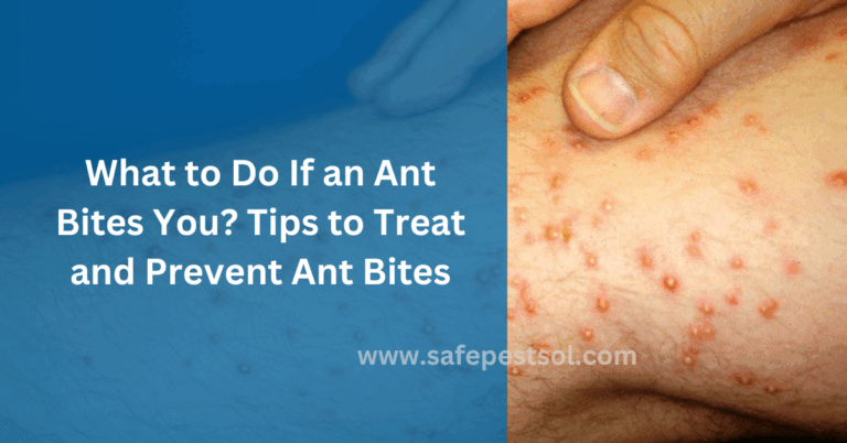 What to Do If an Ant Bites You? Tips to Treat and Prevent Ant Bites