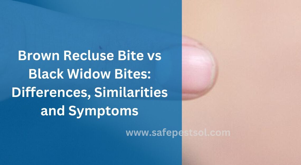Brown Recluse Bite vs Black Widow Bites